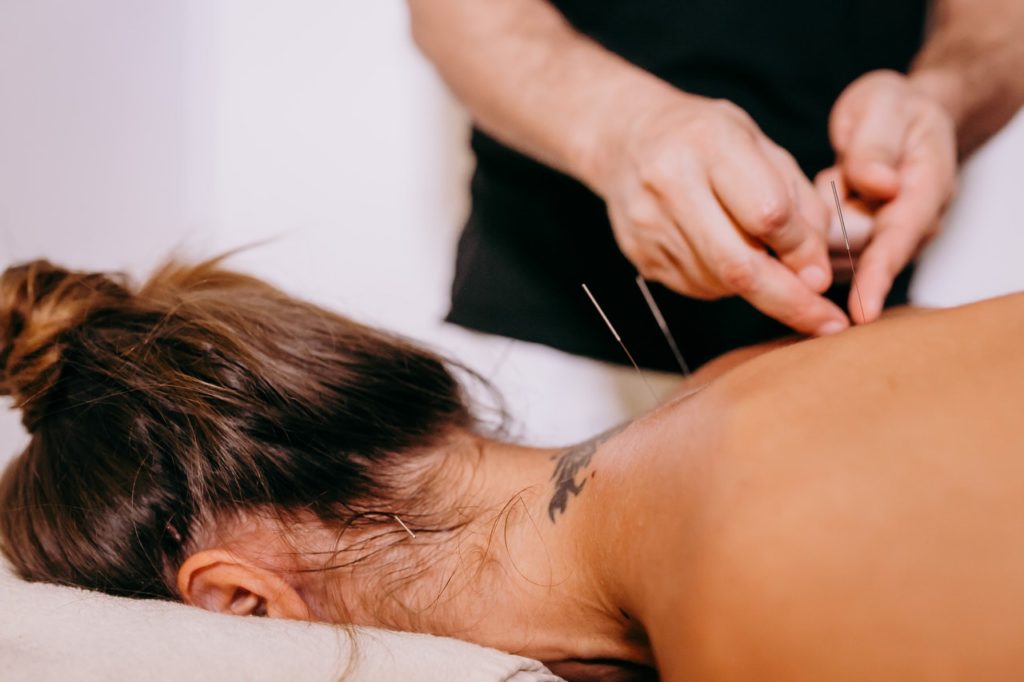 Acupuncture treatment for holistic healing and balance at Awaken and Bloom Women's Health Clinic