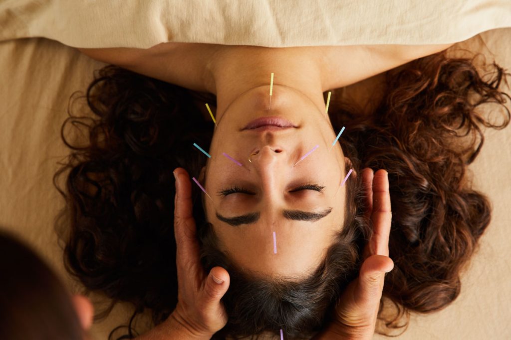 facial acupuncture treatment